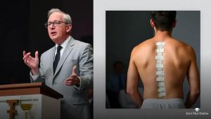 Antes e depois da cirurgia do pastor Nilson Gomes: transformação impressionante